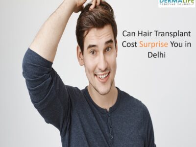 Can Hair Transplant Cost Surprise You in Delhi?